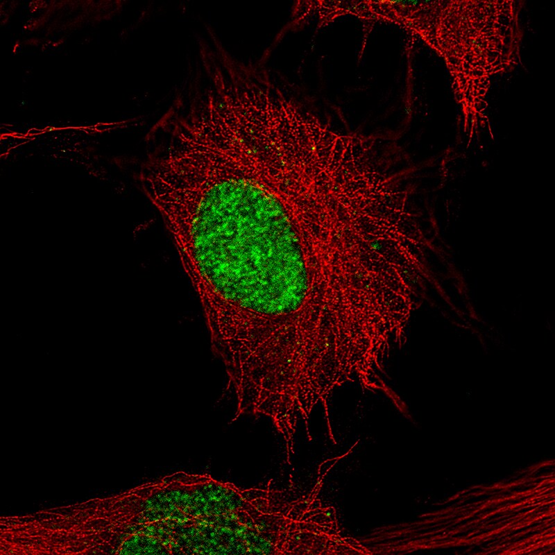 POU3F2/OCT7 Antibody (CL6228) - Azide and BSA Free Immunocytochemistry/ Immunofluorescence: POU3F2/OCT7 Antibody [NBP3-43883]