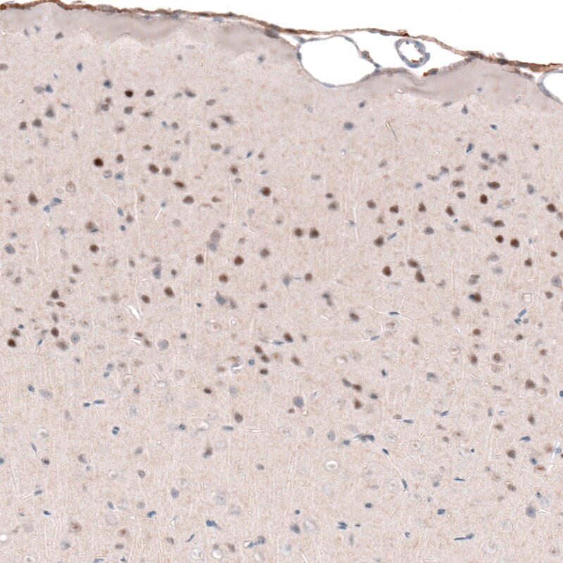 POU3F2/OCT7 Antibody (CL6228) - Azide and BSA Free Immunohistochemistry-Paraffin: POU3F2/OCT7 Antibody [NBP3-43883]