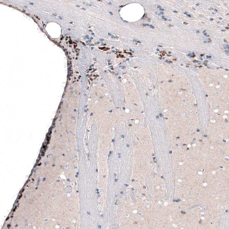POU3F2/OCT7 Antibody (CL6232) - Azide and BSA Free Immunohistochemistry-Paraffin: POU3F2/OCT7 Antibody [NBP3-43884]