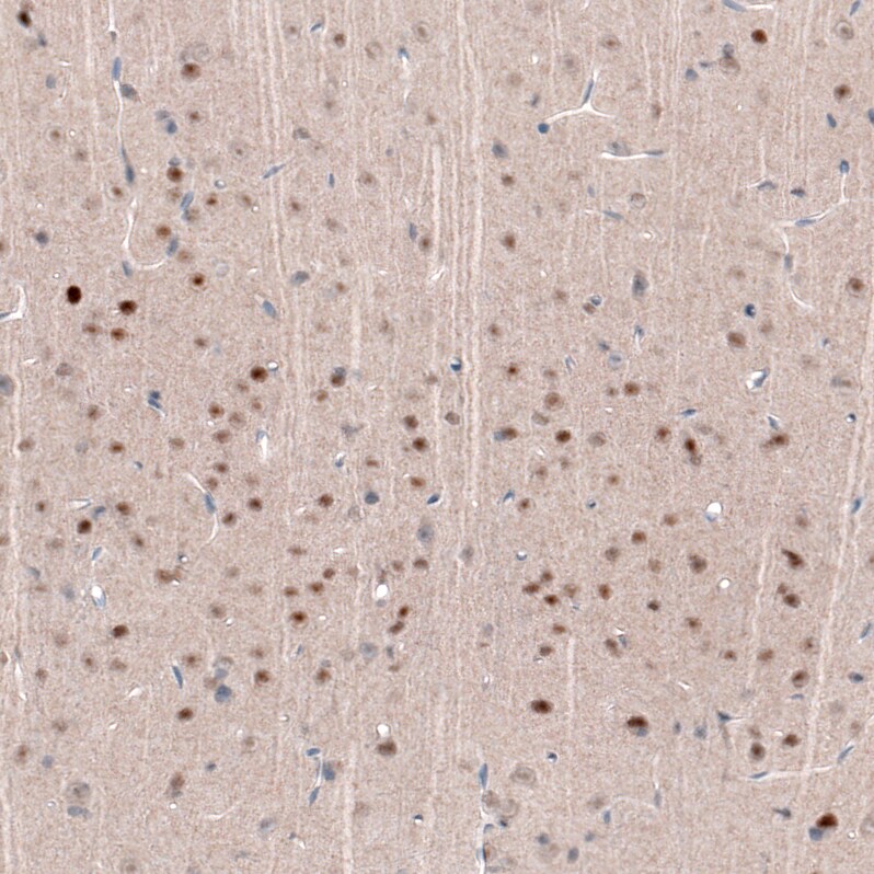 POU3F2/OCT7 Antibody (CL6232) - Azide and BSA Free Immunohistochemistry-Paraffin: POU3F2/OCT7 Antibody [NBP3-43884]