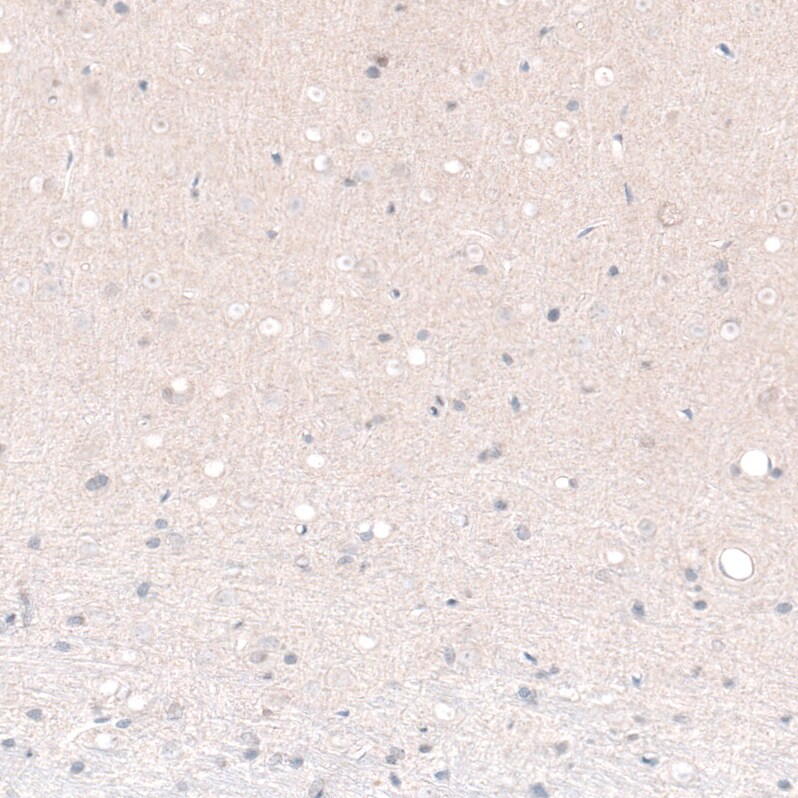 POU3F2/OCT7 Antibody (CL6232) - Azide and BSA Free Immunohistochemistry-Paraffin: POU3F2/OCT7 Antibody [NBP3-43884]