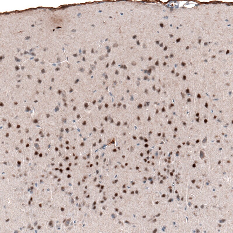 POU3F2/OCT7 Antibody (CL6232) - Azide and BSA Free Immunohistochemistry-Paraffin: POU3F2/OCT7 Antibody [NBP3-43884]