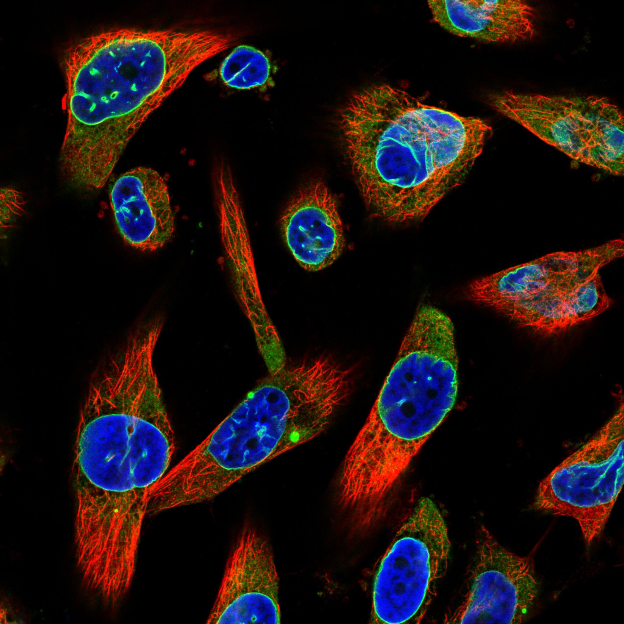 Emerin Antibody (CL0203) - Azide and BSA Free Immunocytochemistry/ Immunofluorescence: Emerin Antibody [NBP3-43886]