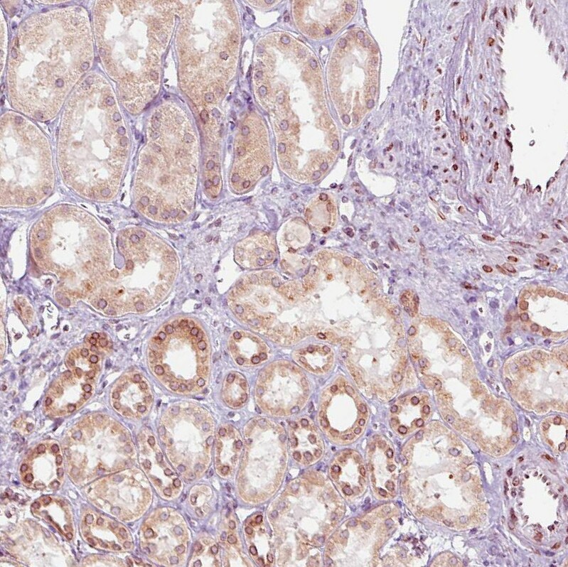 Emerin Antibody (CL0203) - Azide and BSA Free Immunohistochemistry-Paraffin: Emerin Antibody [NBP3-43886]