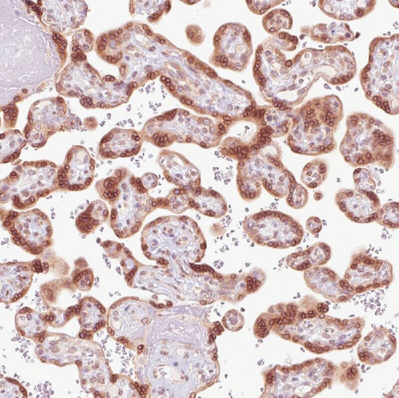 Emerin Antibody (CL0203) - Azide and BSA Free Immunohistochemistry-Paraffin: Emerin Antibody [NBP3-43886]