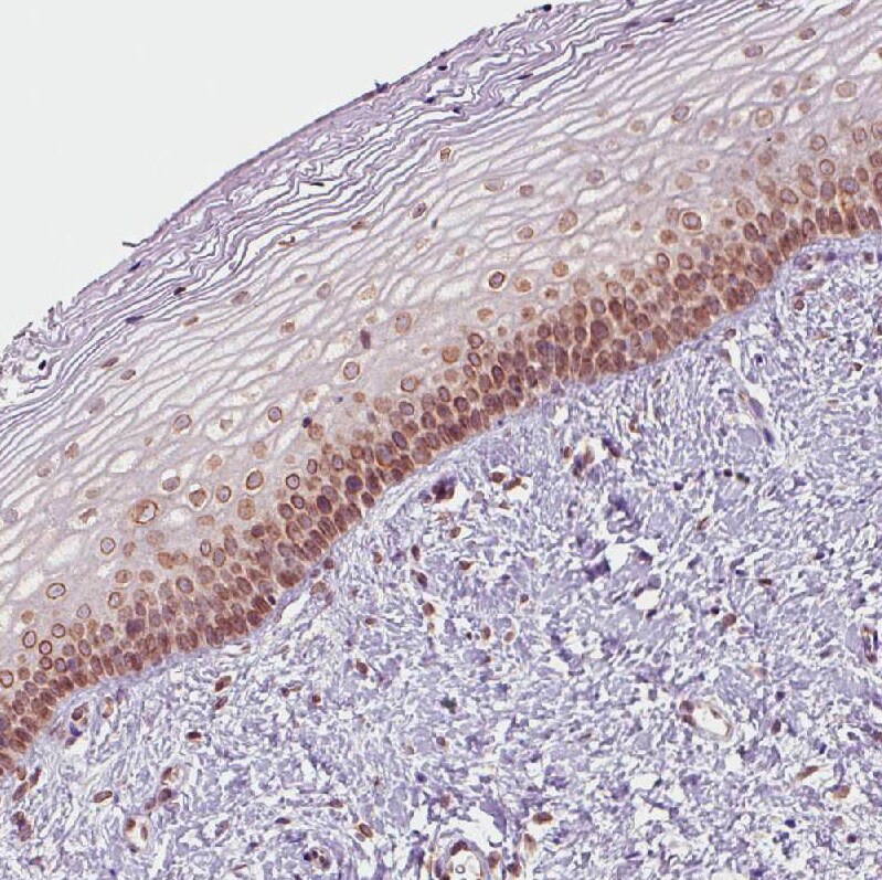 Emerin Antibody (CL0203) - Azide and BSA Free Immunohistochemistry-Paraffin: Emerin Antibody [NBP3-43886]