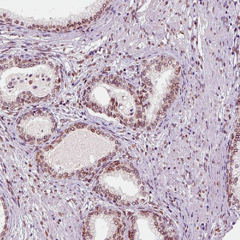Emerin Antibody (CL0203) - Azide and BSA Free Immunohistochemistry-Paraffin: Emerin Antibody [NBP3-43886]
