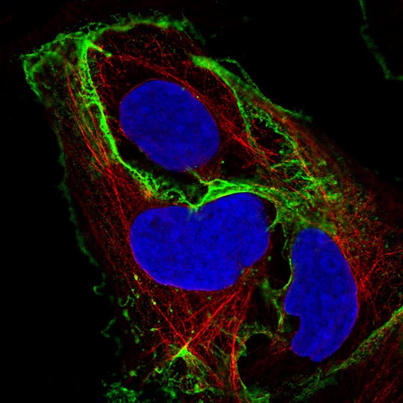 E-Cadherin Antibody (CL1170) - Azide and BSA Free Immunocytochemistry/ Immunofluorescence: E-Cadherin Antibody [NBP3-43887]