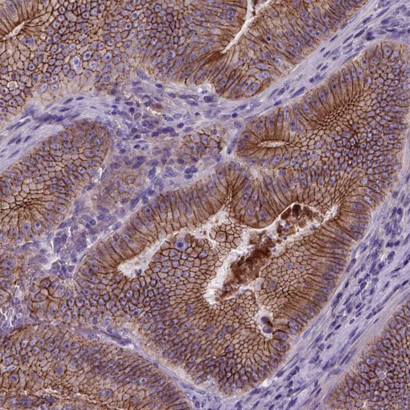E-Cadherin Antibody (CL1170) - Azide and BSA Free Immunohistochemistry-Paraffin: E-Cadherin Antibody [NBP3-43887]