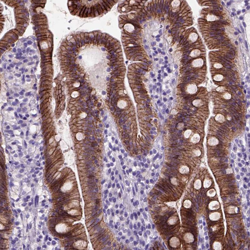 E-Cadherin Antibody (CL1170) - Azide and BSA Free Immunohistochemistry-Paraffin: E-Cadherin Antibody [NBP3-43887]
