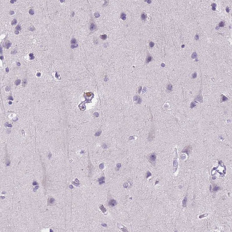 E-Cadherin Antibody (CL1170) - Azide and BSA Free Immunohistochemistry-Paraffin: E-Cadherin Antibody [NBP3-43887]