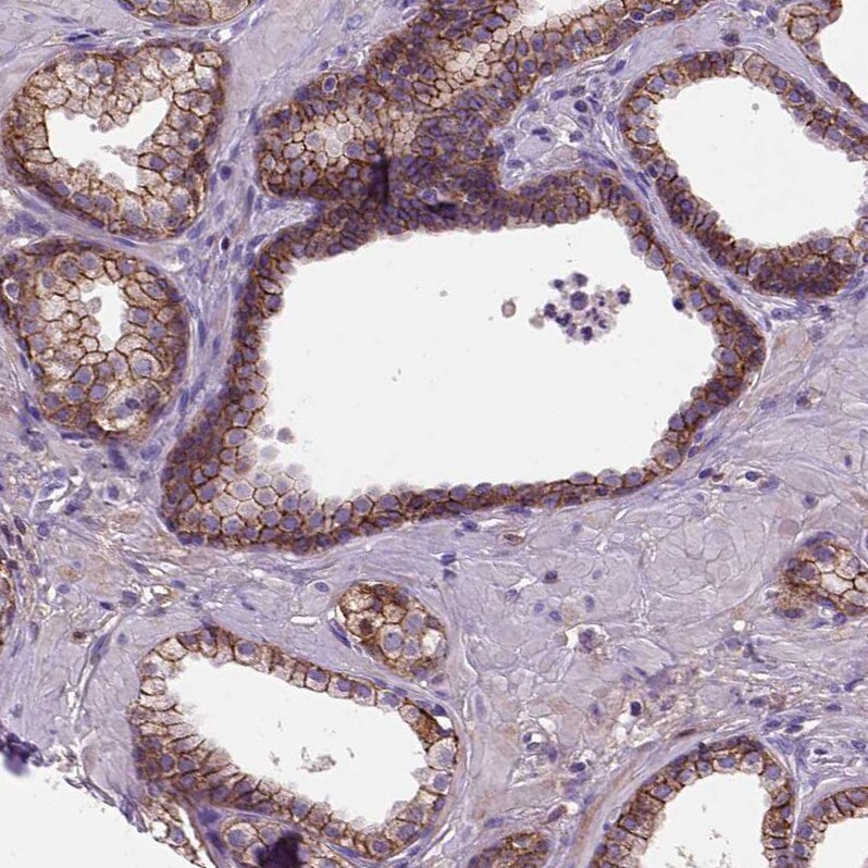 E-Cadherin Antibody (CL1170) - Azide and BSA Free Immunohistochemistry-Paraffin: E-Cadherin Antibody [NBP3-43887]
