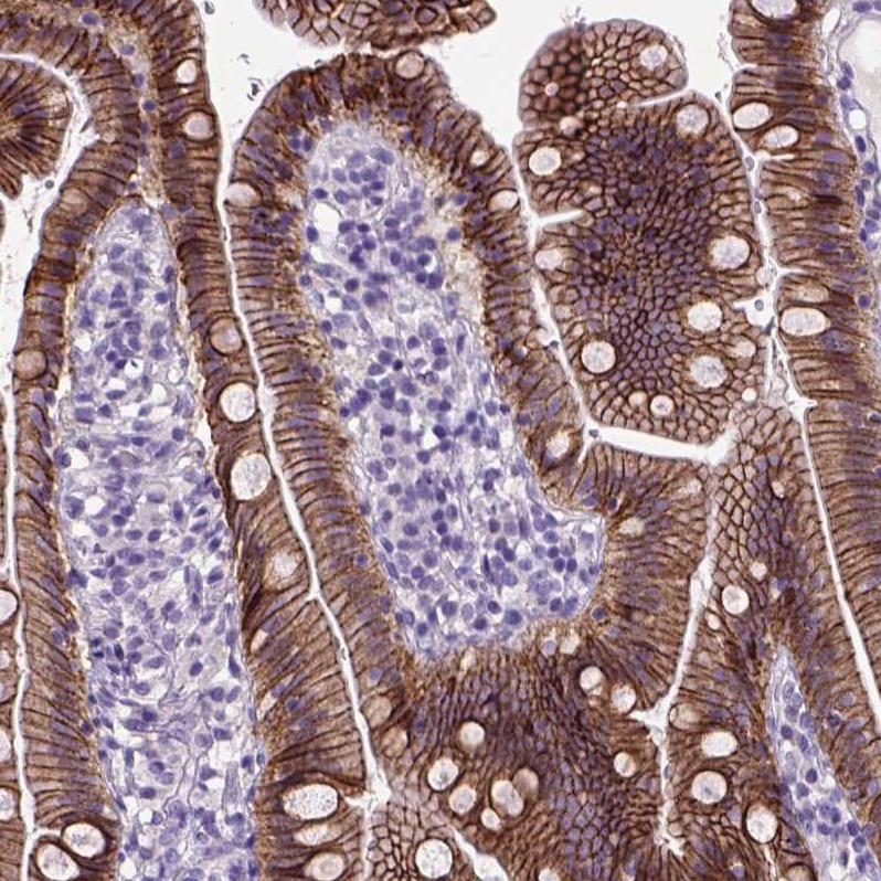E-Cadherin Antibody (CL1172) - Azide and BSA Free Immunohistochemistry-Paraffin: E-Cadherin Antibody [NBP3-43888]