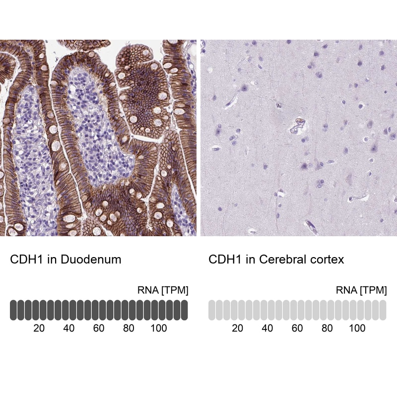 E-Cadherin Antibody (CL1172) - Azide and BSA Free Immunohistochemistry-Paraffin: E-Cadherin Antibody [NBP3-43888]