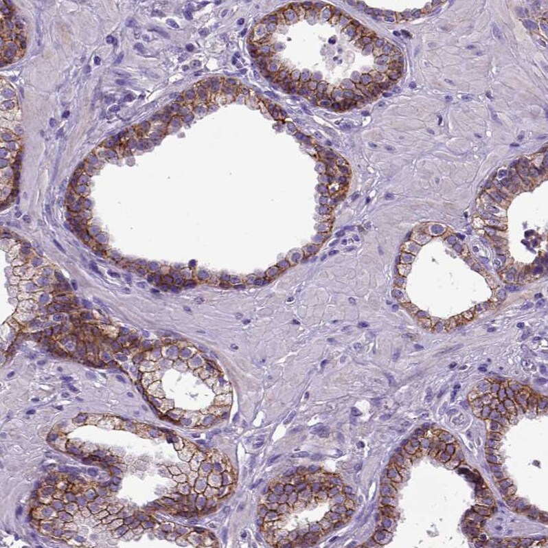 E-Cadherin Antibody (CL1172) - Azide and BSA Free Immunohistochemistry-Paraffin: E-Cadherin Antibody [NBP3-43888]