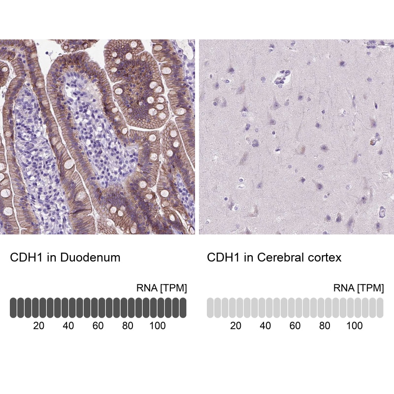 E-Cadherin Antibody (CL1180) - Azide and BSA Free Immunohistochemistry-Paraffin: E-Cadherin Antibody [NBP3-43889]