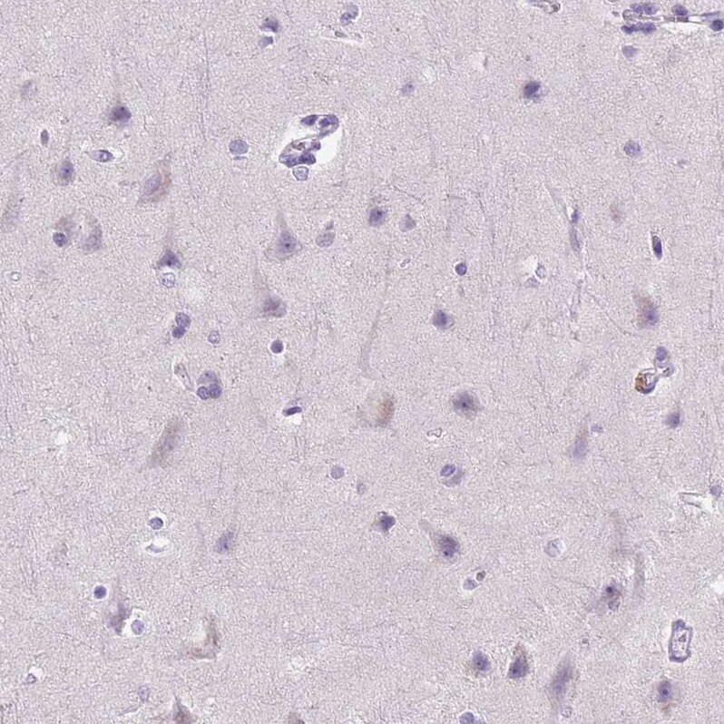 E-Cadherin Antibody (CL1180) - Azide and BSA Free Immunohistochemistry-Paraffin: E-Cadherin Antibody [NBP3-43889]