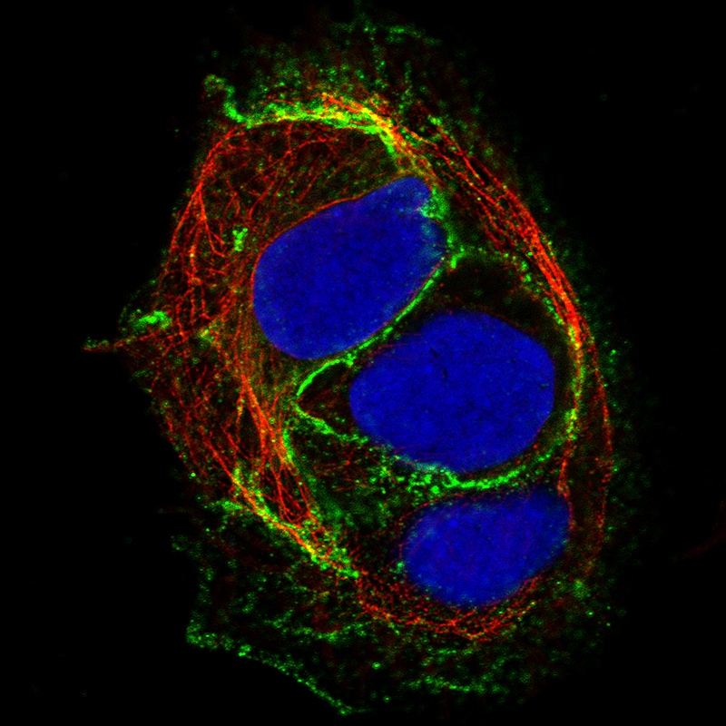 E-Cadherin Antibody (CL1180) - Azide and BSA Free Immunocytochemistry/ Immunofluorescence: E-Cadherin Antibody [NBP3-43889]