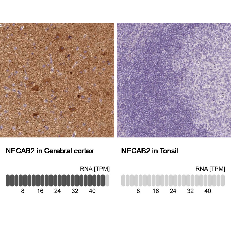 EFCBP2 Antibody (CL0524) - Azide and BSA Free Immunohistochemistry-Paraffin: EFCBP2 Antibody [NBP3-43890]