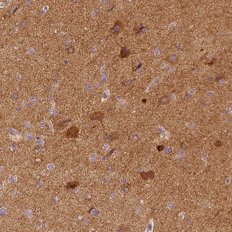 EFCBP2 Antibody (CL0524) - Azide and BSA Free Immunohistochemistry-Paraffin: EFCBP2 Antibody [NBP3-43890]
