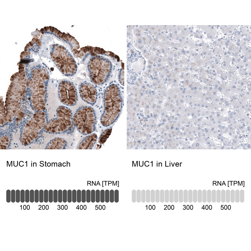 MUC1 Antibody (CL8733) - Azide and BSA Free Immunohistochemistry-Paraffin: MUC1 Antibody [NBP3-43891]