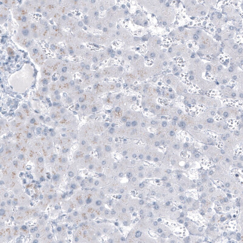 MUC1 Antibody (CL8733) - Azide and BSA Free Immunohistochemistry-Paraffin: MUC1 Antibody [NBP3-43891]