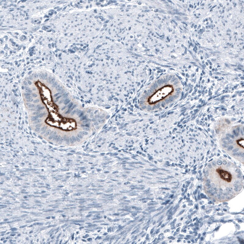 MUC1 Antibody (CL8733) - Azide and BSA Free Immunohistochemistry-Paraffin: MUC1 Antibody [NBP3-43891]