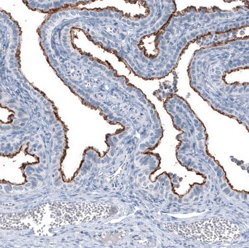 MUC1 Antibody (CL8733) - Azide and BSA Free Immunohistochemistry-Paraffin: MUC1 Antibody [NBP3-43891]