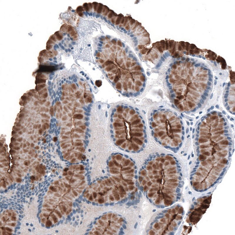 MUC1 Antibody (CL8733) - Azide and BSA Free Immunohistochemistry-Paraffin: MUC1 Antibody [NBP3-43891]