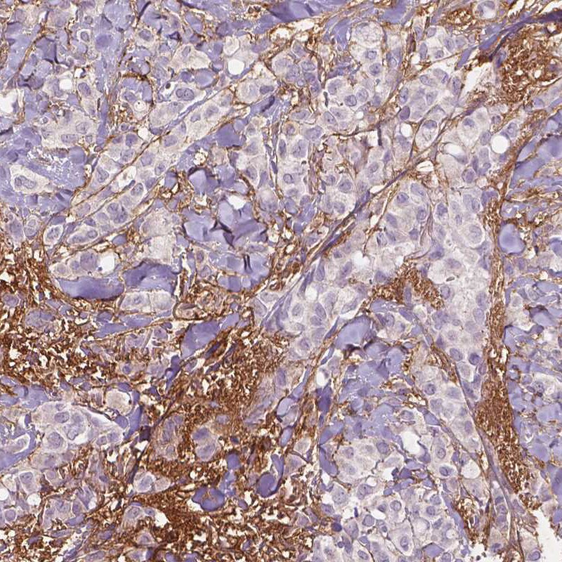 Fibulin 1 Antibody (CL0337) - Azide and BSA Free Immunohistochemistry-Paraffin: Fibulin 1 Antibody [NBP3-43893]