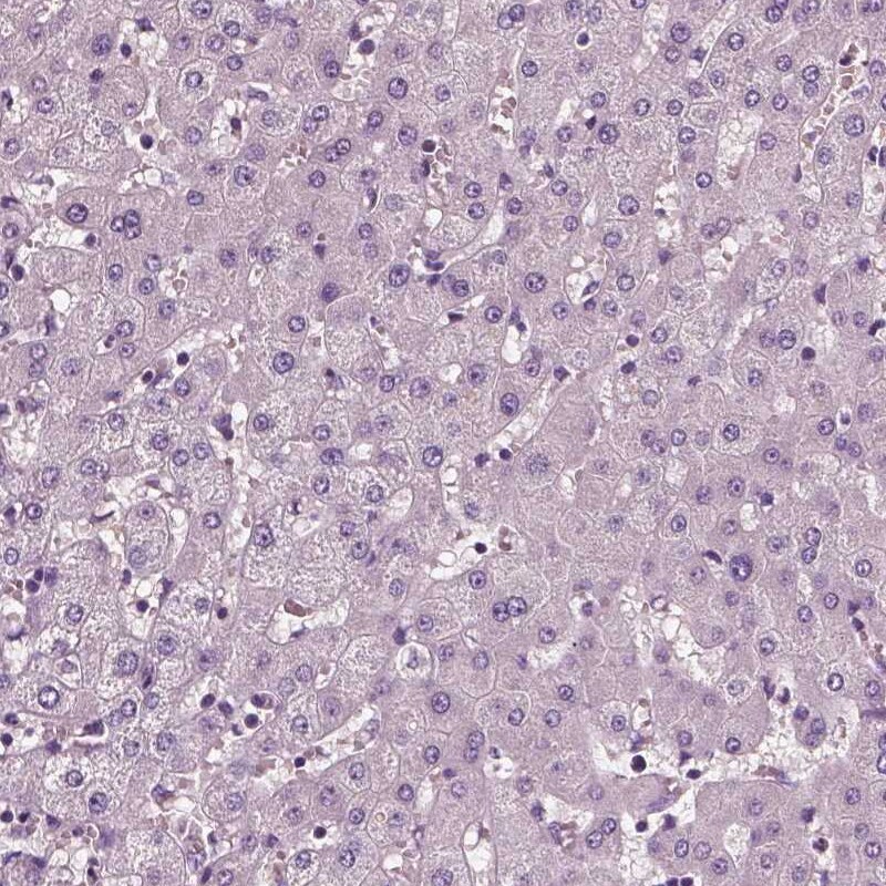 Fibulin 1 Antibody (CL0337) - Azide and BSA Free Immunohistochemistry-Paraffin: Fibulin 1 Antibody [NBP3-43893]
