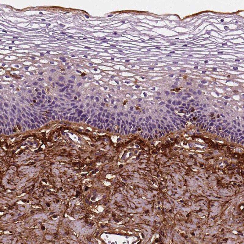 Fibulin 1 Antibody (CL0337) - Azide and BSA Free Immunohistochemistry-Paraffin: Fibulin 1 Antibody [NBP3-43893]