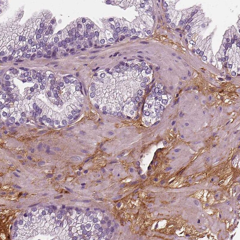 Fibulin 1 Antibody (CL0337) - Azide and BSA Free Immunohistochemistry-Paraffin: Fibulin 1 Antibody [NBP3-43893]