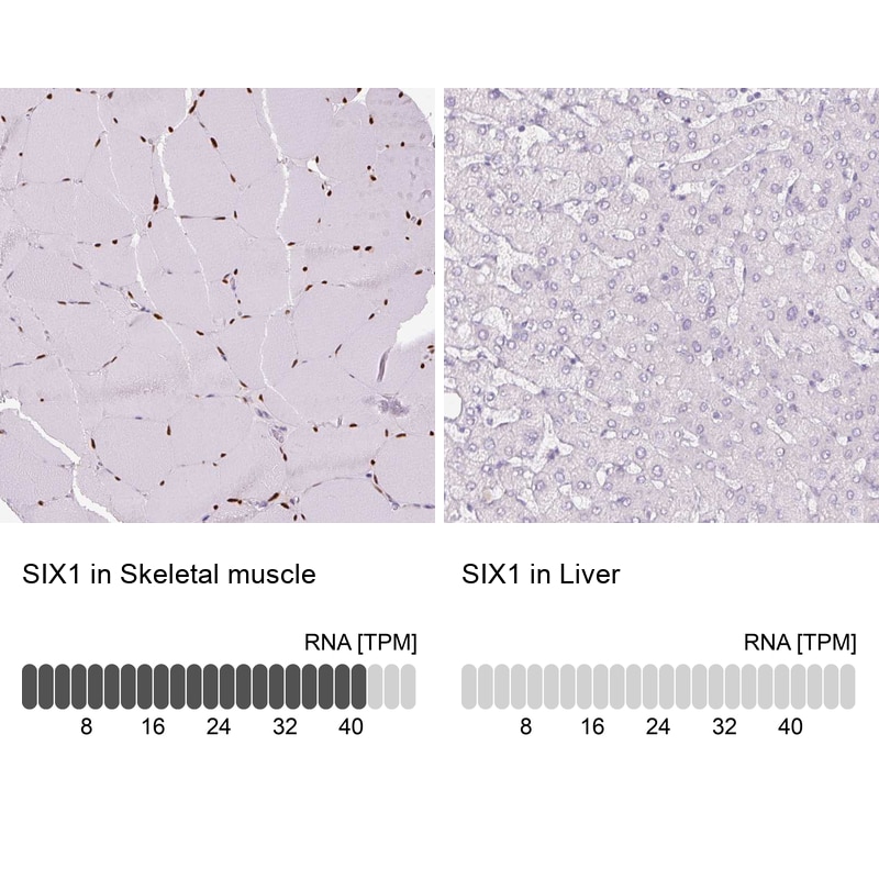 SIX1 Antibody (CL0185) - Azide and BSA Free Immunohistochemistry-Paraffin: SIX1 Antibody [NBP3-43894]