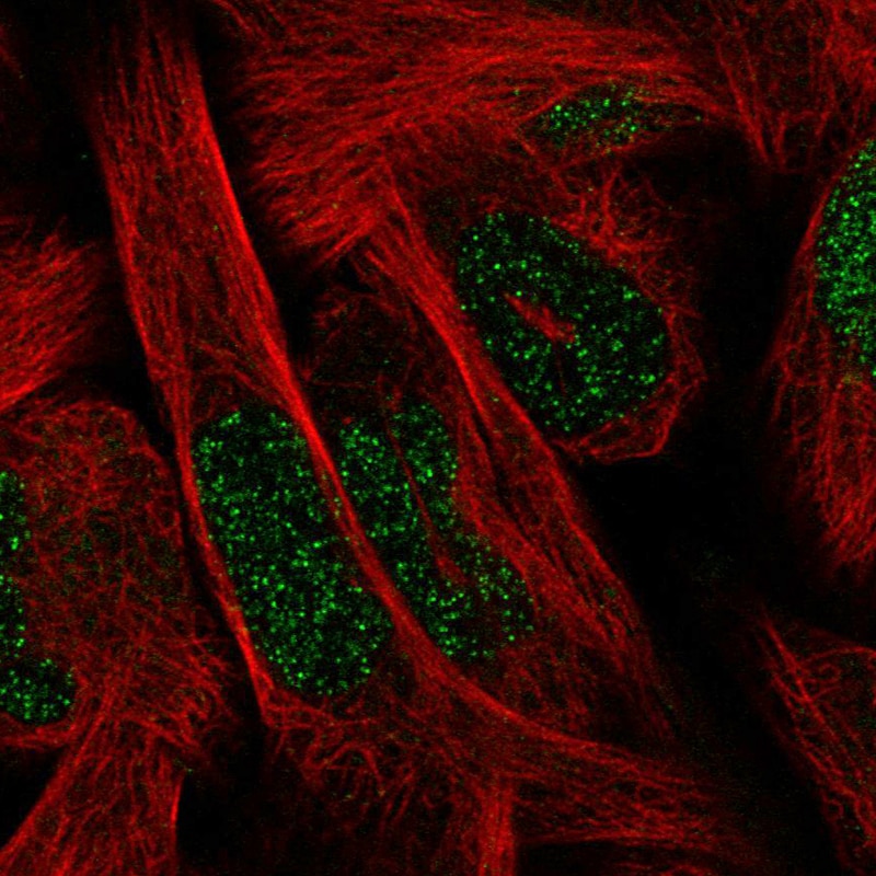 SIX1 Antibody (CL0185) - Azide and BSA Free Immunocytochemistry/ Immunofluorescence: SIX1 Antibody [NBP3-43894]