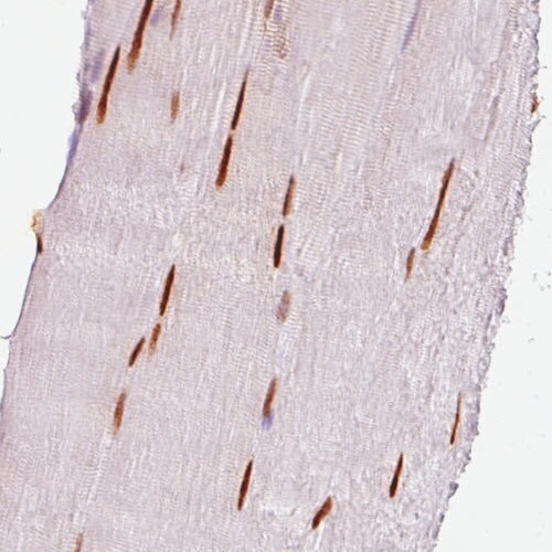 SIX1 Antibody (CL0185) - Azide and BSA Free Immunohistochemistry-Paraffin: SIX1 Antibody [NBP3-43894]