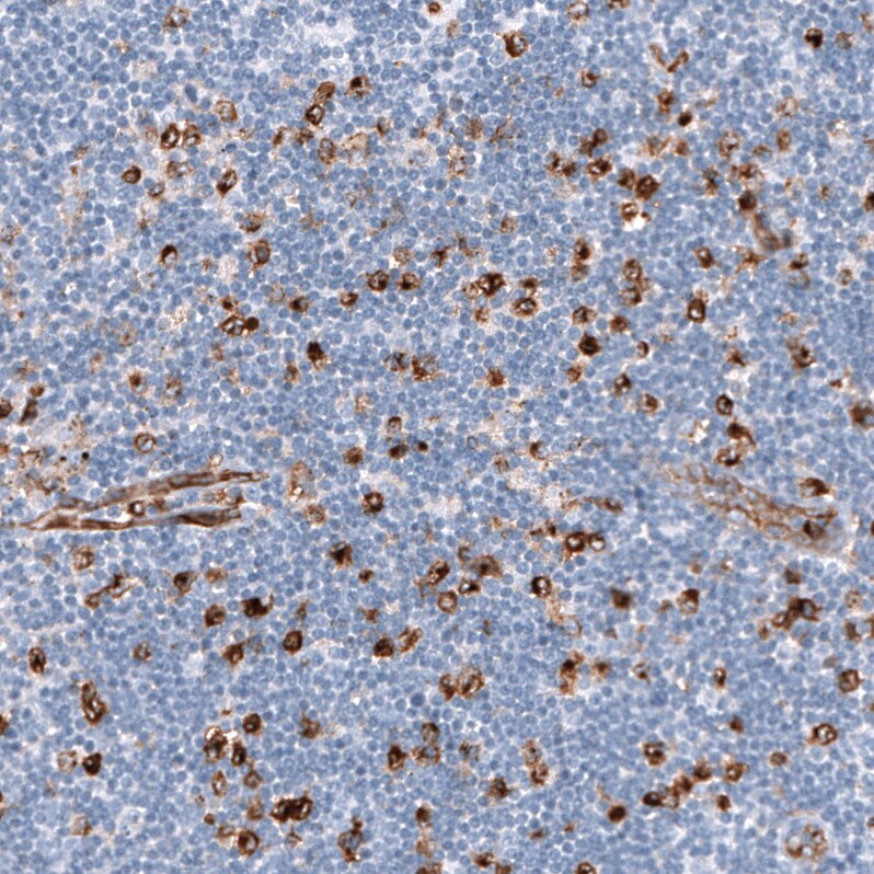 Dysferlin Antibody (CL10888) - Azide and BSA Free Immunohistochemistry-Paraffin: Dysferlin Antibody [NBP3-43895]