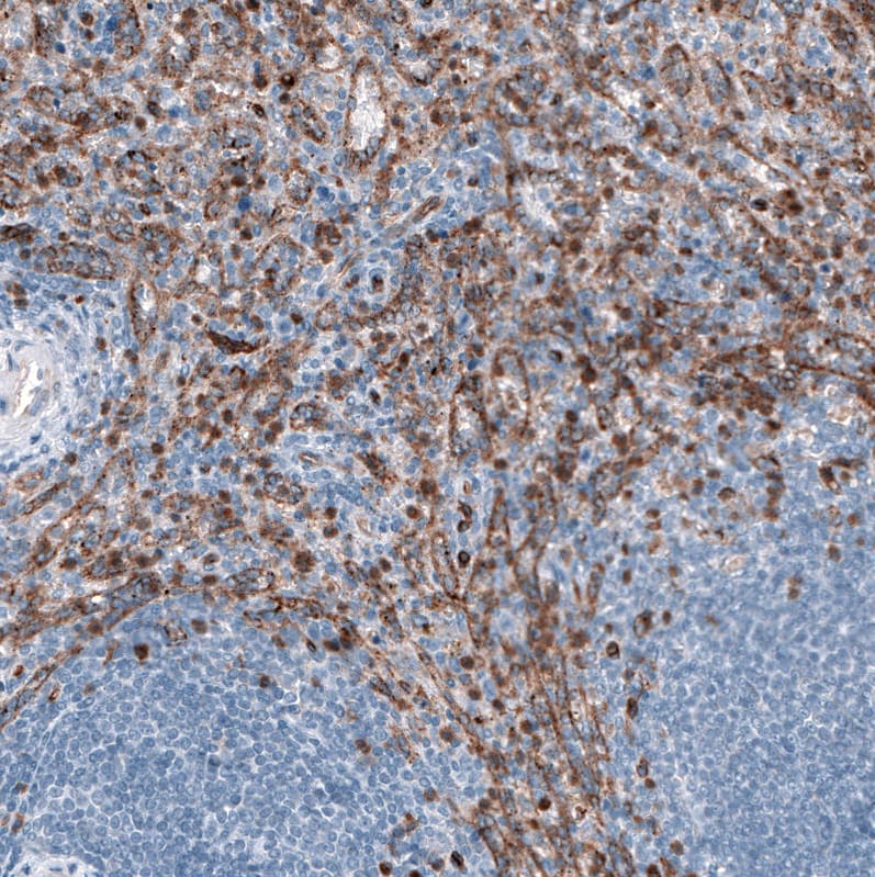Dysferlin Antibody (CL10888) - Azide and BSA Free Immunohistochemistry-Paraffin: Dysferlin Antibody [NBP3-43895]