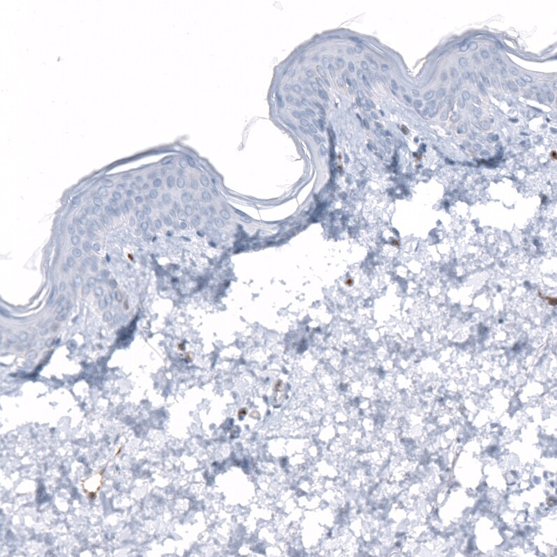 Dysferlin Antibody (CL10888) - Azide and BSA Free Immunohistochemistry-Paraffin: Dysferlin Antibody [NBP3-43895]