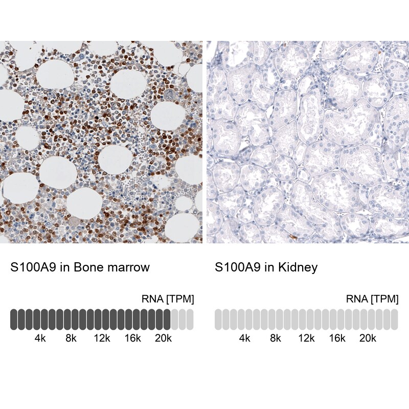 S100A9 Antibody (CL11191) - Azide and BSA Free Immunohistochemistry-Paraffin: S100A9 Antibody [NBP3-43896]