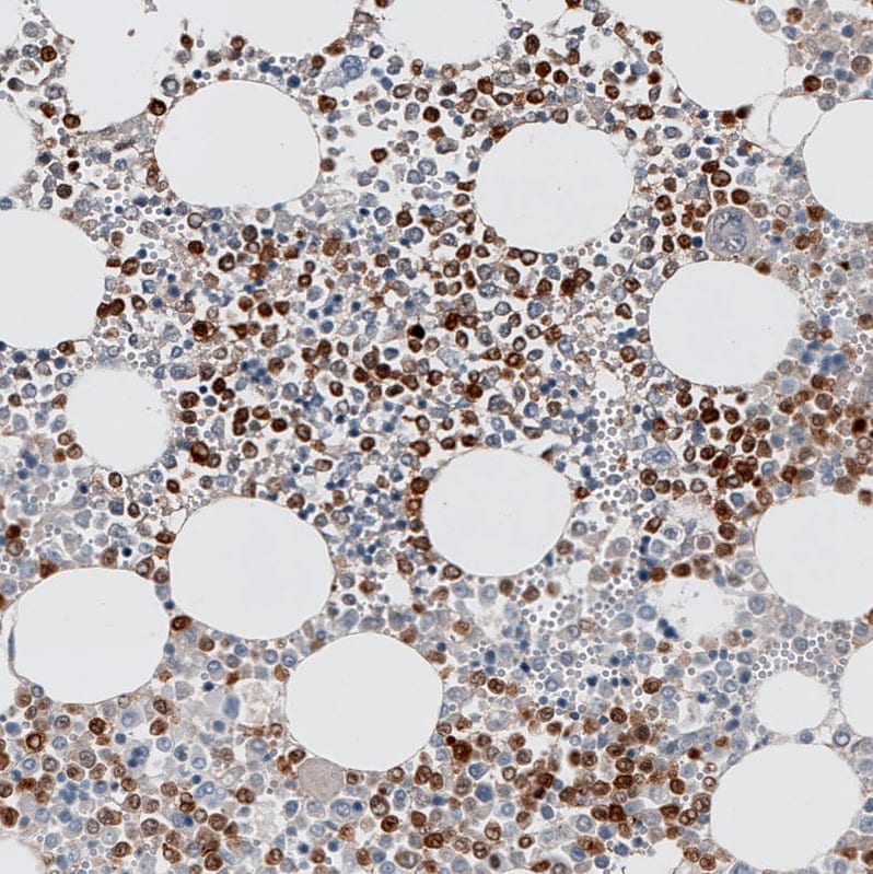 S100A9 Antibody (CL11191) - Azide and BSA Free Immunohistochemistry-Paraffin: S100A9 Antibody [NBP3-43896]