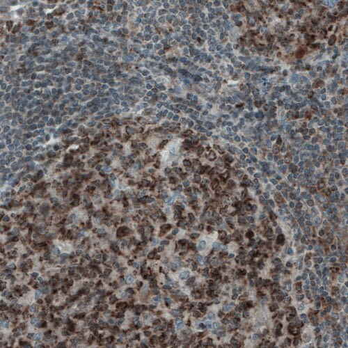 Mcl-1 Antibody (CL1128) - Azide and BSA Free Immunohistochemistry-Paraffin: Mcl-1 Antibody [NBP3-43898]