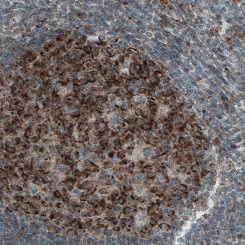 Mcl-1 Antibody (CL1128) - Azide and BSA Free Immunohistochemistry-Paraffin: Mcl-1 Antibody [NBP3-43898]