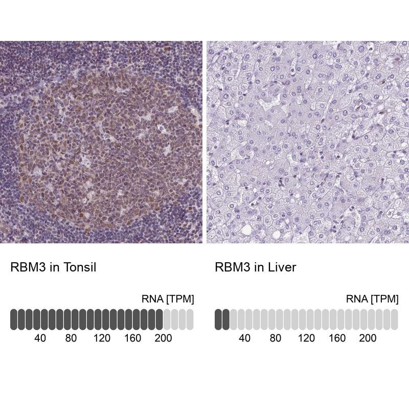 RBM3 Antibody (CL0296) - Azide and BSA Free Immunohistochemistry-Paraffin: RBM3 Antibody [NBP3-43899]