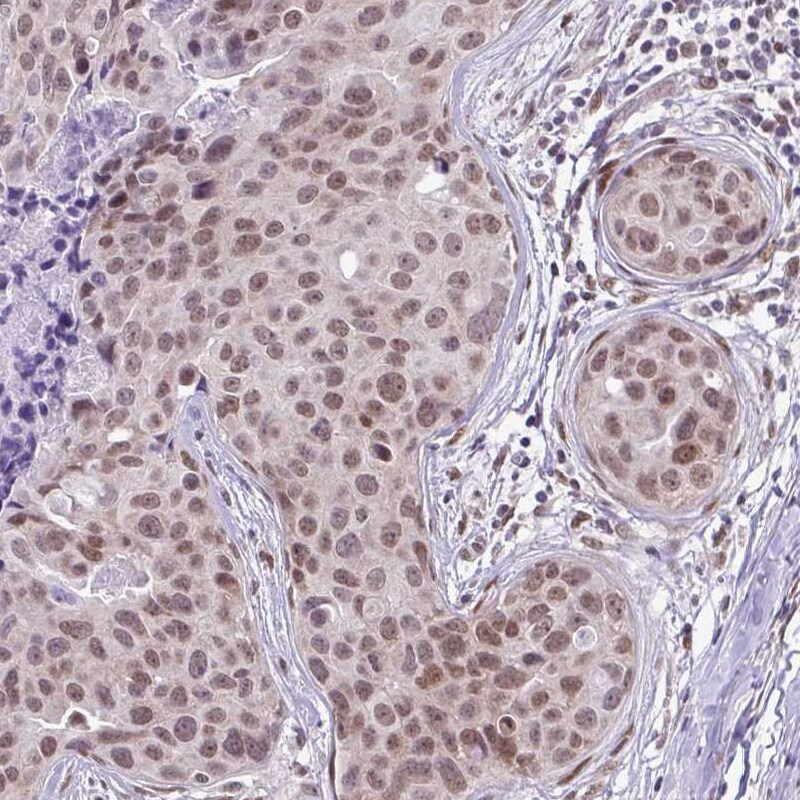 RBM3 Antibody (CL0296) - Azide and BSA Free Immunohistochemistry-Paraffin: RBM3 Antibody [NBP3-43899]