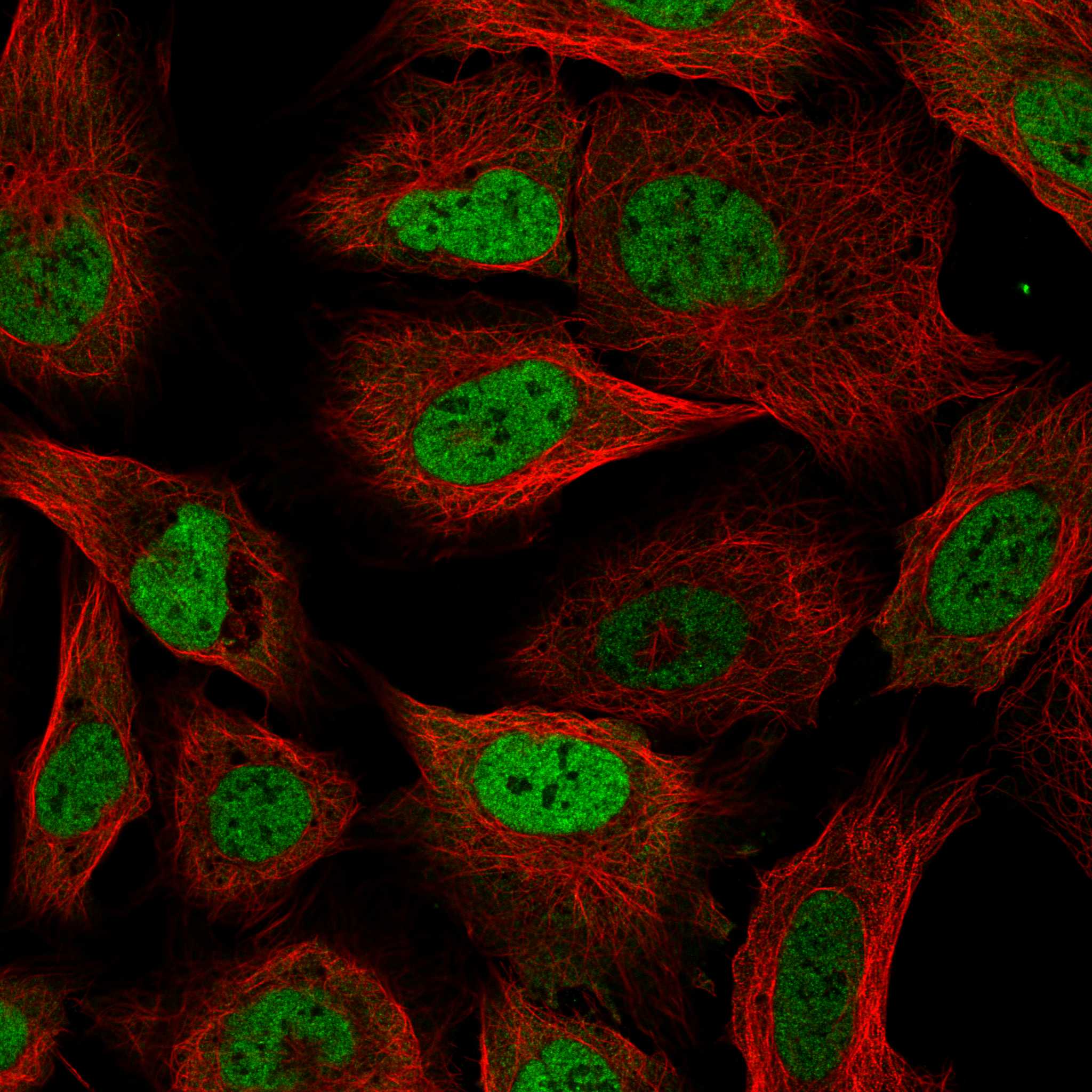 RBM3 Antibody (CL0296) - Azide and BSA Free Immunocytochemistry/ Immunofluorescence: RBM3 Antibody [NBP3-43899]