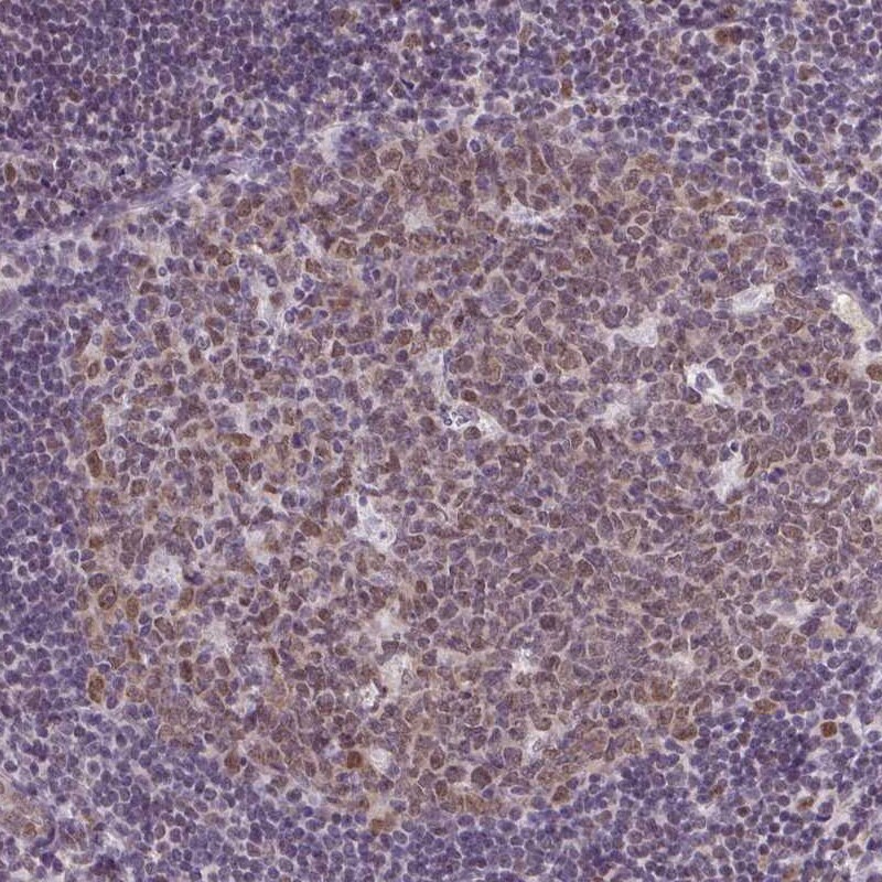 RBM3 Antibody (CL0296) - Azide and BSA Free Immunohistochemistry-Paraffin: RBM3 Antibody [NBP3-43899]