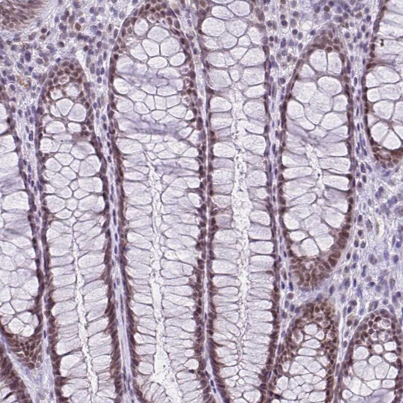 RBM3 Antibody (CL0296) - Azide and BSA Free Immunohistochemistry-Paraffin: RBM3 Antibody [NBP3-43899]