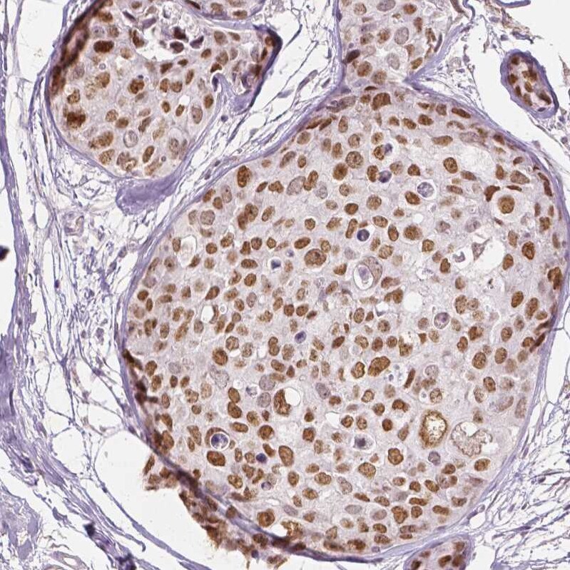 Lysine (K)-specific Demethylase 5B/KDM5B/JARID1B Antibody (CL1129) - Azide and BSA Free Immunohistochemistry-Paraffin: Lysine (K)-specific Demethylase 5B/KDM5B/JARID1B Antibody [NBP3-43901]