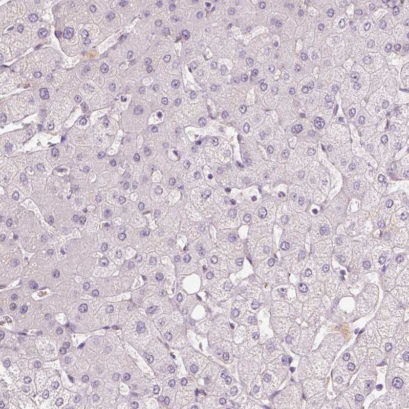 Lysine (K)-specific Demethylase 5B/KDM5B/JARID1B Antibody (CL1129) - Azide and BSA Free Immunohistochemistry-Paraffin: Lysine (K)-specific Demethylase 5B/KDM5B/JARID1B Antibody [NBP3-43901]